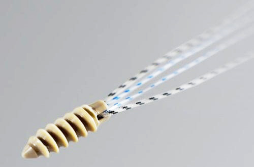 YY/T1867-2023帶線錨釘力學性能測試方法及儀器